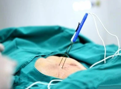 Methods Of Pancreatic Cancer Treatment