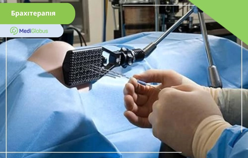 застосування брахітерапії для точного впливу на пухлину Процедура брахітерапії — точне введення джерела радіації в ділянку розташування пухлини