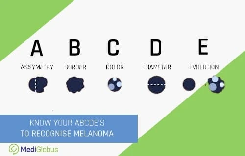 how to recognize skin cancer mole