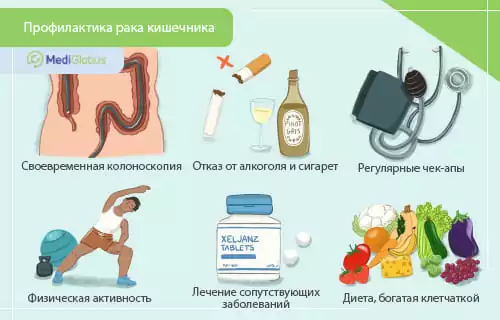 Рекомендации гастроэнтеролога: как предотвратить развитие рака кишечника?