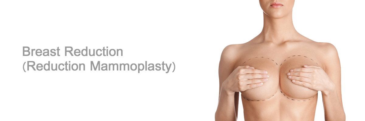 Breast Plastic Surgery or Mammoplasty  Medical Tourism with MediGlobus:  The best treatment around the world