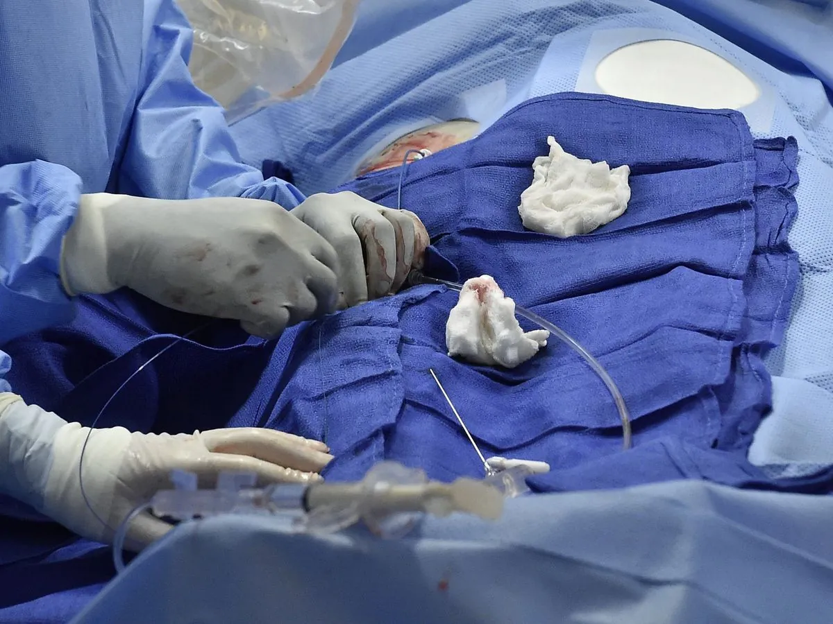 What Should You Know About Stenting Before Procedure?