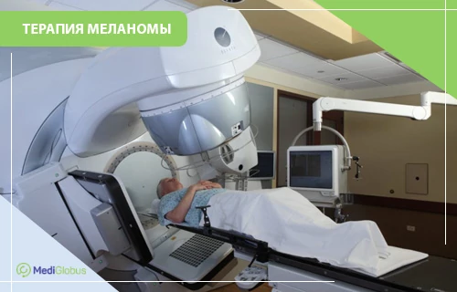 Радиотерапия при меланоме Пациент проходит лучевую терапию: лежит на столе под большим медицинским аппаратом‑линейным ускорителем, рядом мониторы и оборудование для контроля процедуры