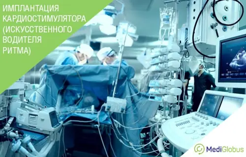 Кардиолог отвечает на часто задаваемые вопросы о кардиостимуляторах