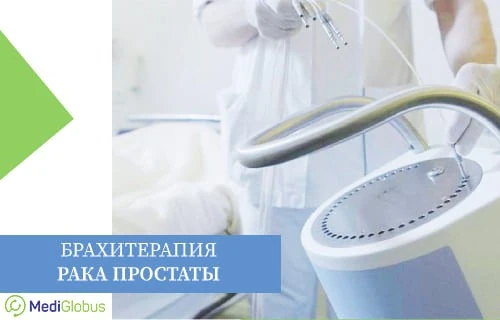 Брахитерапия в рамках лечения рака простаты Обзор современных методов лечения рака простаты