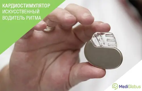 Кардиолог отвечает на часто задаваемые вопросы о кардиостимуляторах