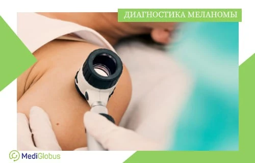 Диагностика меланомы Врач в перчатках проводит дерматоскопию — осмотр родинки на плече пациента с помощью увеличительного прибора