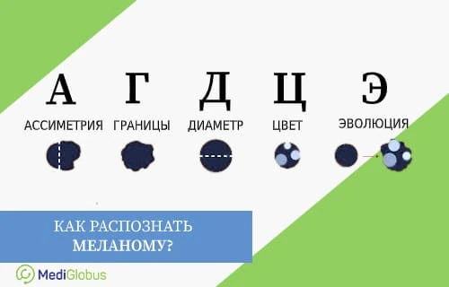 Как распознать рак кожи? Инфографика: Как распознать рак кожи?