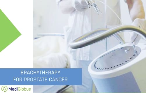 brachytherapy for prostate cancer 