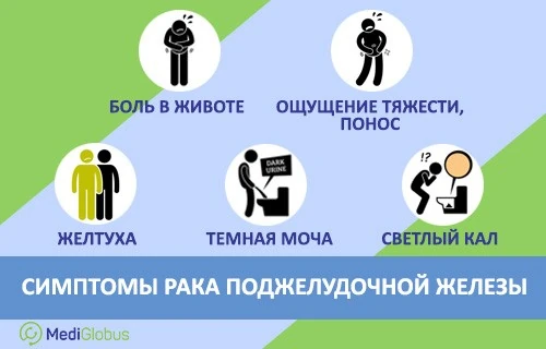 Рак поджелудочной железы — причины, симптомы, шансы на излечение