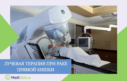 радиотерапия рака прямой кишки