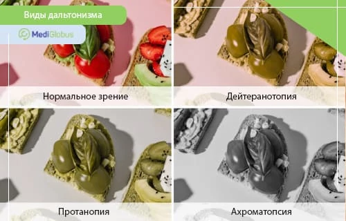 дальтонизм