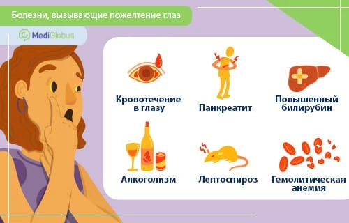 пожелтение глаз лечение