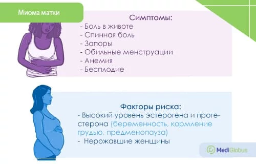 Миома матки: причины и признаки Инфографика: Причины и признаки миомы матки