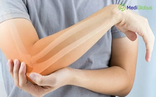 Treatment of Joints Abroad. Arthritis, Arthrosis and Rheumatism