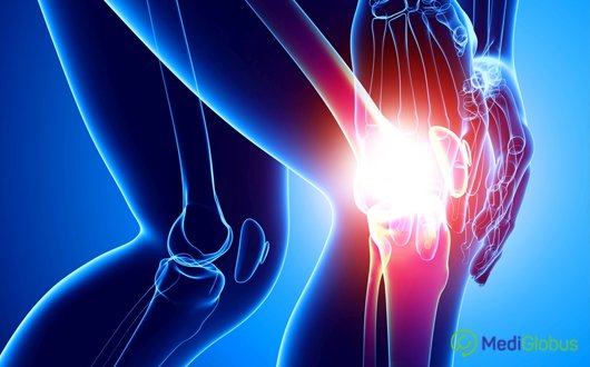 Tünetek és az arthrosis kezelése 2. fokozat: a betegség teljes leírása Artrózis múmia kezelés