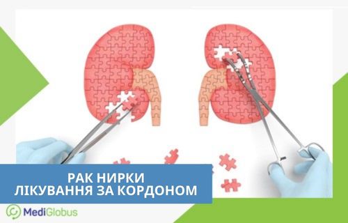 Прогноз при раку нирки 1-ї стадії — успішне лікування та відновлення функції органу Ілюстрація лікування раку нирки — нирки у вигляді пазлів, лікар вставляє відсутні елементи