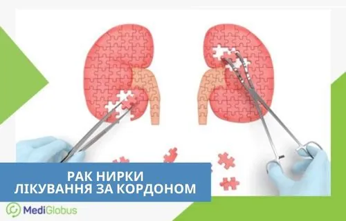 Ілюстрація лікування раку нирки — нирки у вигляді пазлів, лікар вставляє відсутні елементи