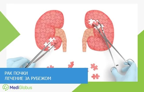 Иллюстрация лечения рака почки — почки в виде пазлов, врач вставляет недостающие элементы