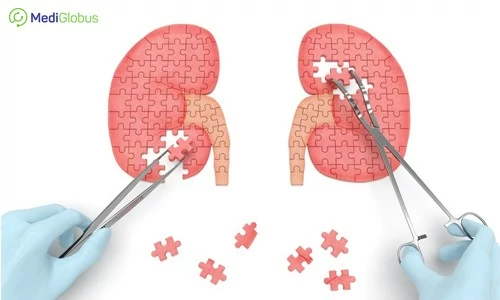 kidney cancer treatment abroad