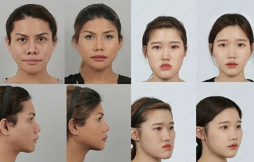 results-of-plastic-surgery at id hospital