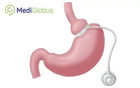 obesity treatment