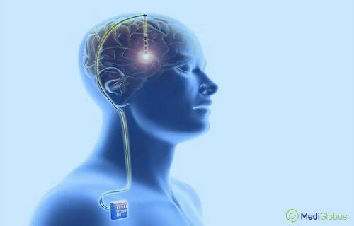 Neurological diseases and modern therapy
