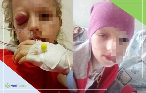 відмінності в доступності препаратів і технологій — як це впливає на лікування пацієнтів дитина під час лікування та після поліпшення стану — результати хіміотерапії