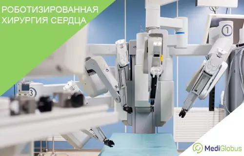 Роботизированная хирургия сердца Роботизированная хирургическая система Da Vinci в операционной — несколько механических манипуляторов с инструментами расположены над операционным столом, покрытым голубой стерильной простынёй