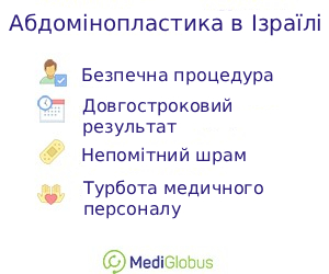 abdominoplasty_inisrael_ukr Переваги абдомінопластики в Ізраїлі
