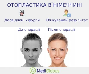 otoplasty_ingermay_ukr Переваги проведення отопластики в Німеччині