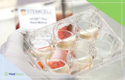 perspectives of cell therapy