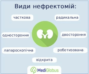 types_of_nepherctomy_ukr Види нефректомій (операцій з видалення нирки) діаграма