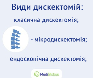 discectomy_types_ukr Які існують типи дискектомій