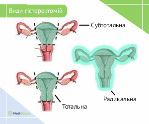 hysterectomy_types_ukr
