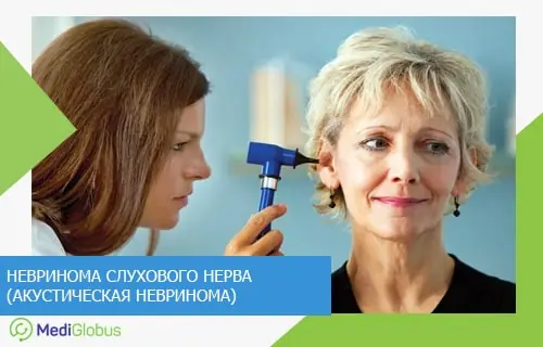 что такое акустическая неврома врач-отоларинголог проводит осмотр уха женщины с помощью отоскопа