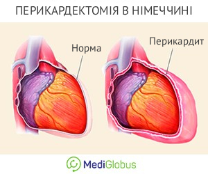 pericardectomy_germany_ukr Проведенния перикардектомії в Німеччині