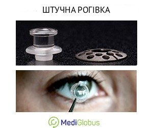 artificial_cornea_ukr Як виглядає штучна рогівка