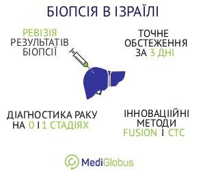 biopsy_israel_ukr Особливості проведення біопсії в Ізраїлі