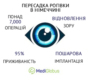 cornealtranspl_germany_ukr Інформація про пересадку рогівки ока в Німеччині