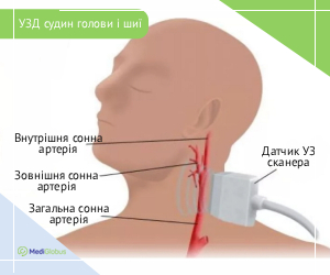 dopplerography_ukr Ультразвукова доплерографія судин голови і шиї