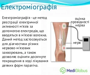 electromyography_ukr Що таке електроміографія пояснення