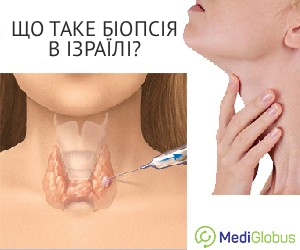thyroid_biopsy_israel_ukr Біопсія щитовидної залози в Ізраїлі