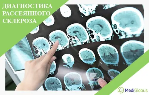 Сколько стоит лечение рассеянного склероза за рубежом?