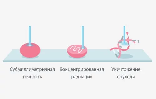 Центр протонной терапии Кирон Салюд