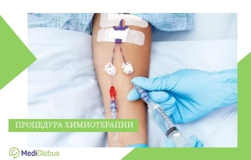 Что такое химиотерапия?