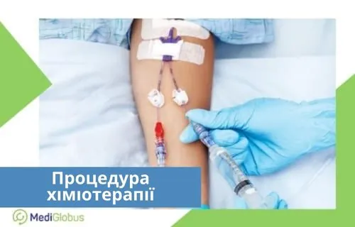 Як відбувається процедура хіміотерапії? Як проводиться хіміотерапія?