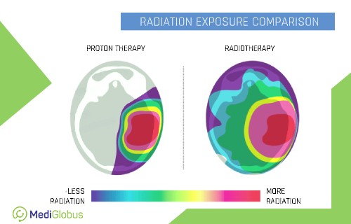 Comparison table irradiation radiotherapy and proton therapy