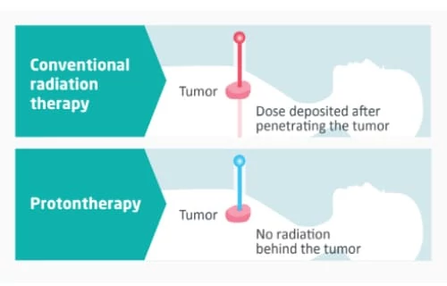 Quironsalud Proton Therapy Center
