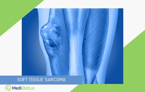 What is soft tissue sarcoma?